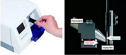 數(shù)字口內(nèi)影像板掃描處理系統(tǒng)-牙片寶 數(shù)字口內(nèi)影像板掃描處理系統(tǒng)-牙片寶