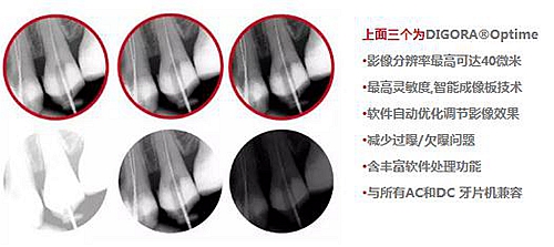 數(shù)字口內(nèi)影像板掃描處理系統(tǒng)-牙片寶 數(shù)字口內(nèi)影像板掃描處理系統(tǒng)-牙片寶