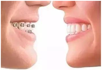 關于牙齒矯正，你想知道的都在這！