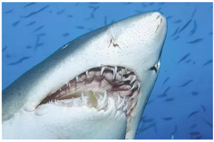 固定假牙(烤瓷牙)的致命缺點(diǎn) 固定假牙(烤瓷牙)的致命缺點(diǎn)