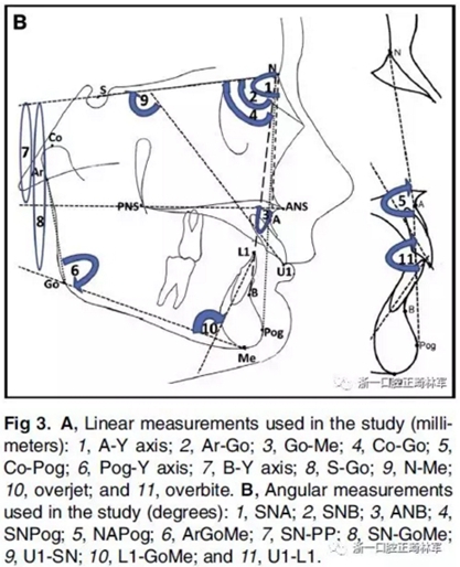 正畸矯正 正畸矯正