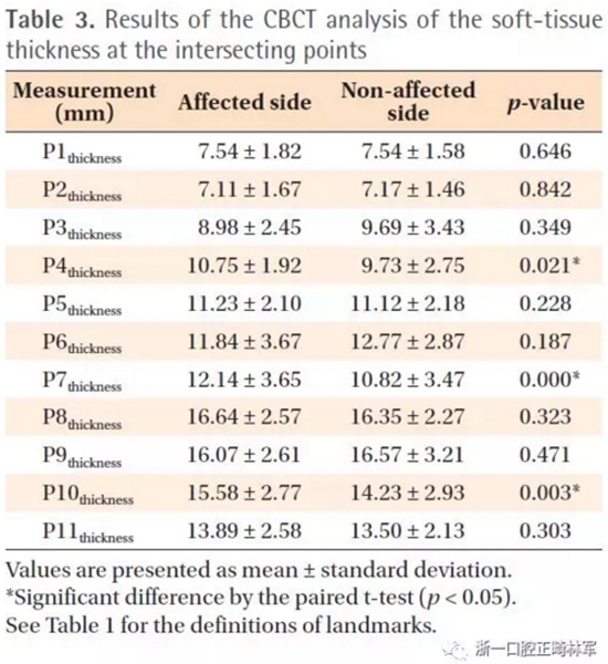 正畸文獻(xiàn)閱讀--無(wú)癥狀單側(cè)唇腭裂患者面中部不對(duì)稱的三維分析 正畸文獻(xiàn)閱讀--無(wú)癥狀單側(cè)唇腭裂患者面中部不對(duì)稱的三維分析