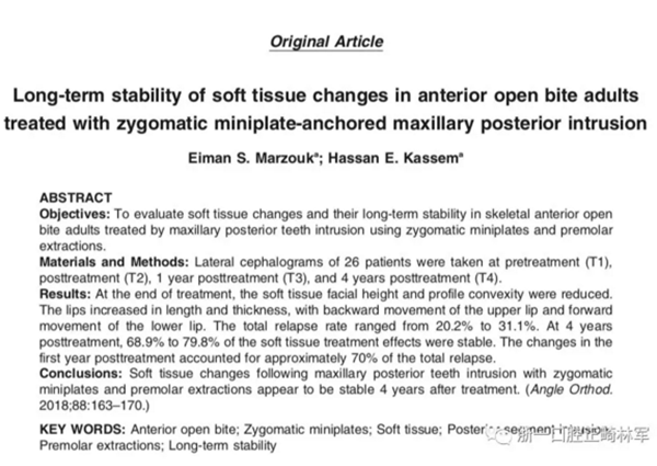 上頜后牙 上頜后牙