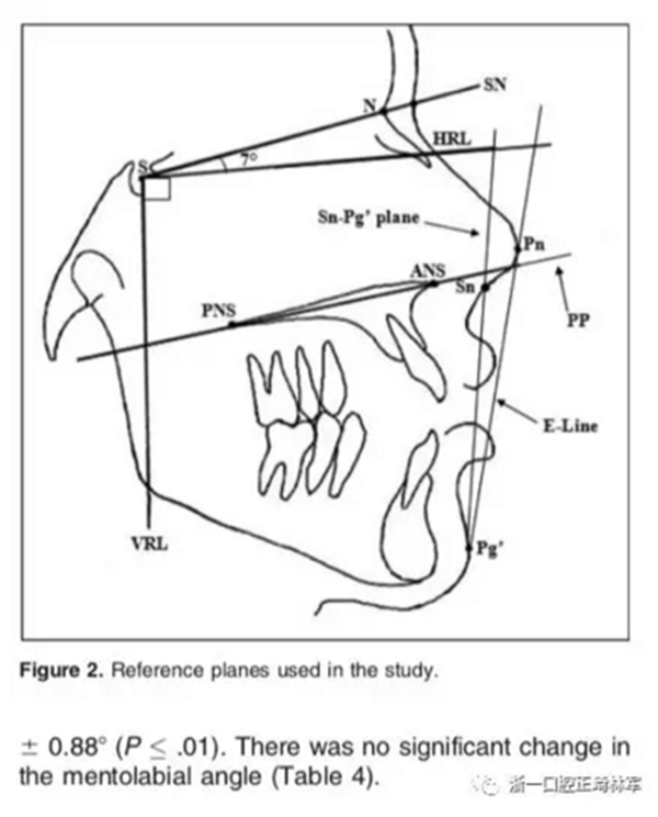 上頜后牙 上頜后牙