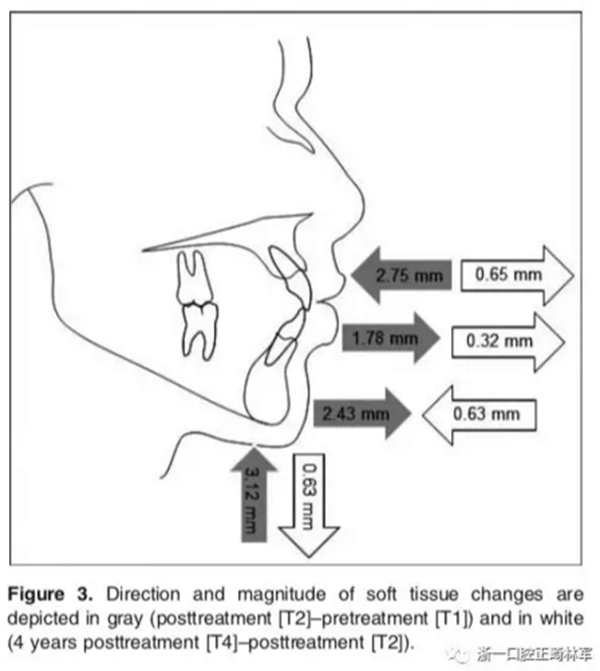 上頜后牙 上頜后牙