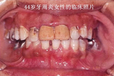 上海品瑞邁格磁致伸縮治療儀 上海品瑞邁格磁致伸縮治療儀