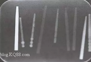 纖維樁修復(fù)之精細(xì)操作 纖維樁修復(fù)之精細(xì)操作