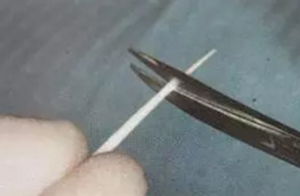 纖維樁修復(fù)之精細(xì)操作 纖維樁修復(fù)之精細(xì)操作