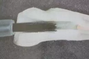 纖維樁修復(fù)之精細(xì)操作 纖維樁修復(fù)之精細(xì)操作