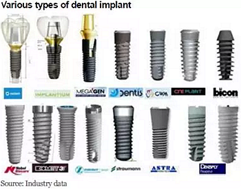種植體，在全球牙科設備市場的變化！