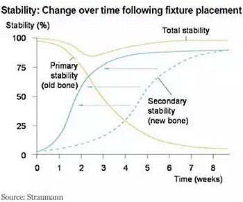 種植體，在全球牙科設備市場的變化！