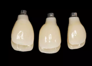 【病例分享】上頜多顆相鄰前牙的“精確化”即刻種植修復(fù)一例 【病例分享】上頜多顆相鄰前牙的“精確化”即刻種植修復(fù)一例