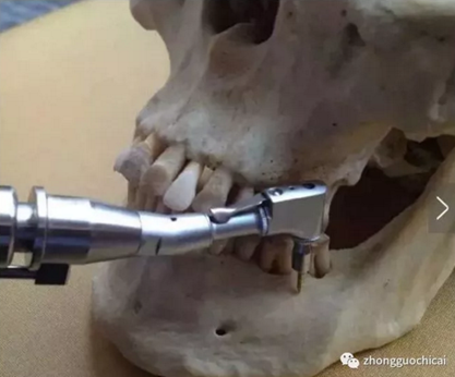 特殊植入部位及注意事項(xiàng) 特殊植入部位及注意事項(xiàng)