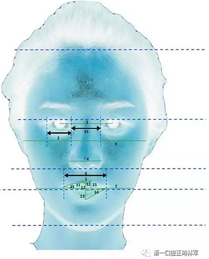 正畸文獻(xiàn)閱讀--對美貌年輕女性面部尺寸的分析 正畸文獻(xiàn)閱讀--對美貌年輕女性面部尺寸的分析