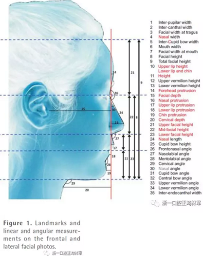 正畸文獻(xiàn)閱讀--對美貌年輕女性面部尺寸的分析 正畸文獻(xiàn)閱讀--對美貌年輕女性面部尺寸的分析