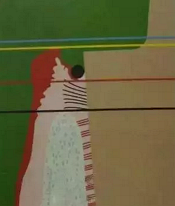 雙線排齦在口腔臨床冠修復(fù)上的應(yīng)用 雙線排齦在口腔臨床冠修復(fù)上的應(yīng)用