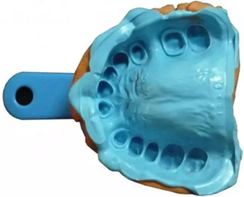 【分享】高水平義齒制作工藝流程 【分享】高水平義齒制作工藝流程