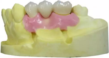 【分享】高水平義齒制作工藝流程 【分享】高水平義齒制作工藝流程