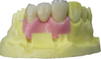 【分享】高水平義齒制作工藝流程 【分享】高水平義齒制作工藝流程