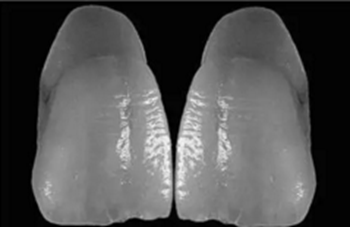 【分享】高水平義齒制作工藝流程 【分享】高水平義齒制作工藝流程