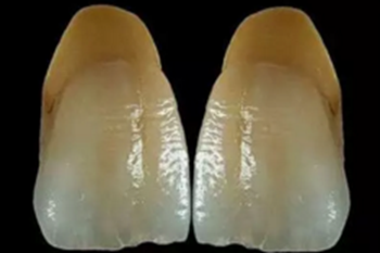 【分享】高水平義齒制作工藝流程 【分享】高水平義齒制作工藝流程