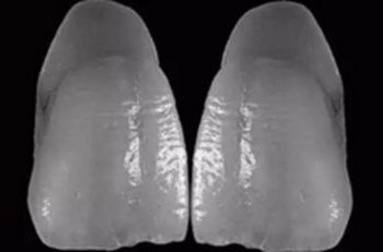 【分享】高水平義齒制作工藝流程 【分享】高水平義齒制作工藝流程
