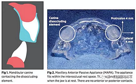 正畸文獻(xiàn)閱讀--剖析合板part 2 正畸文獻(xiàn)閱讀--剖析合板part 2