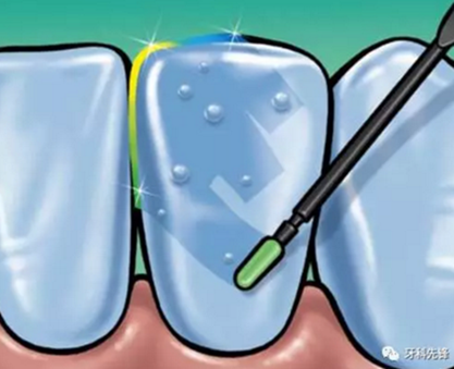 0~6歲寶寶口腔知識干貨集錦 0~6歲寶寶口腔知識干貨集錦