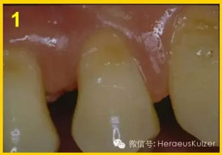 簡單治療——格魯瑪脫敏劑的應(yīng)用 簡單治療——格魯瑪脫敏劑的應(yīng)用