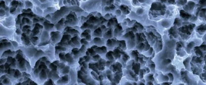 士卓曼ITI種植體到底好在哪？——種植牙行業(yè)淺析