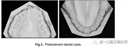 正畸文獻(xiàn)閱讀--單側(cè)唇腭裂患者的多學(xué)科綜合序列治療 正畸文獻(xiàn)閱讀--單側(cè)唇腭裂患者的多學(xué)科綜合序列治療