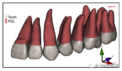 正畸文獻閱讀--對于滑動法關(guān)閉間隙的有限元分析 正畸文獻閱讀--對于滑動法關(guān)閉間隙的有限元分析