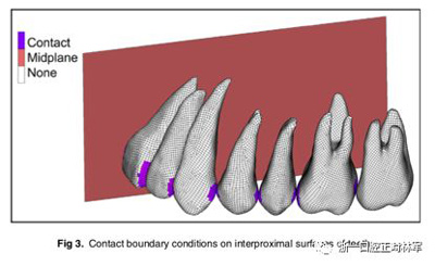 正畸文獻閱讀--對于滑動法關(guān)閉間隙的有限元分析 正畸文獻閱讀--對于滑動法關(guān)閉間隙的有限元分析