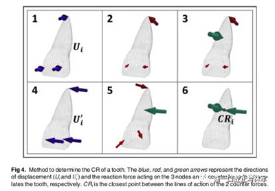 正畸文獻閱讀--對于滑動法關(guān)閉間隙的有限元分析 正畸文獻閱讀--對于滑動法關(guān)閉間隙的有限元分析