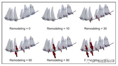 正畸文獻閱讀--對于滑動法關(guān)閉間隙的有限元分析 正畸文獻閱讀--對于滑動法關(guān)閉間隙的有限元分析