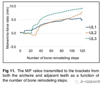 正畸文獻閱讀--對于滑動法關(guān)閉間隙的有限元分析 正畸文獻閱讀--對于滑動法關(guān)閉間隙的有限元分析