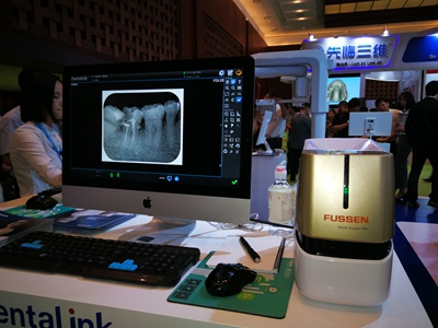 菲森牙智寶 菲森牙智寶