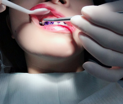 99%的人都不知道怎樣才算把牙齒刷干凈了！