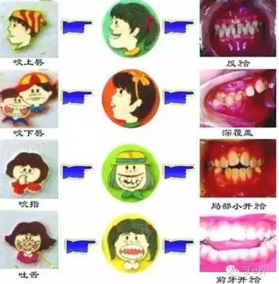 }W6[@F9%Z6SI%F3_QE84WKB.png }W6[@F9%Z6SI%F3_QE84WKB.png