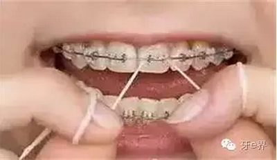 H86_Z1YX$8V`1)B5Y0(56LP.png H86_Z1YX$8V`1)B5Y0(56LP.png