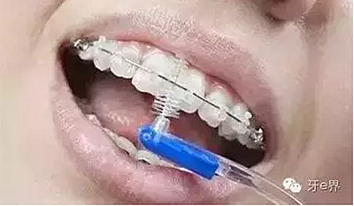 OW19$K$M_(AH3D(5{G4MP`E.png OW19$K$M_(AH3D(5{G4MP`E.png