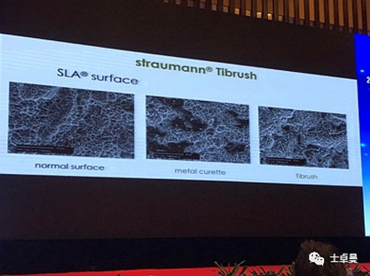 從風(fēng)險(xiǎn)因素控制到及時(shí)有效治療，Dr. Laurence Adriaens深度解析種植體周圍炎的防治