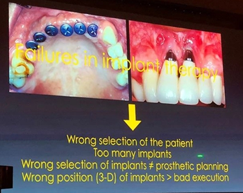 課堂筆記 | 看大師如何運(yùn)用數(shù)字化流程解決復(fù)雜病例 課堂筆記 | 看大師如何運(yùn)用數(shù)字化流程解決復(fù)雜病例