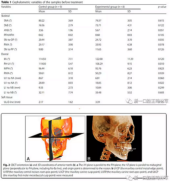 正畸文獻閱讀--用舌側滑動牽引系統(tǒng)控制前牙區(qū)段:初步的CBCT研究 正畸文獻閱讀--用舌側滑動牽引系統(tǒng)控制前牙區(qū)段:初步的CBCT研究