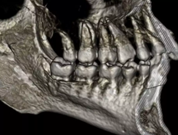 正畸文獻賞析--CBCT在正畸中的廣泛應用 正畸文獻賞析--CBCT在正畸中的廣泛應用