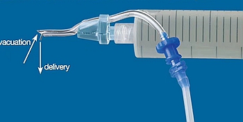 廣州蕙帆根管負(fù)壓系統(tǒng) 廣州蕙帆根管負(fù)壓系統(tǒng)