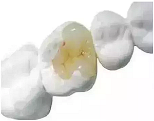 你總?cè)轮囱?ldquo;貴”還不是你自己造成的 你總?cè)轮囱?ldquo;貴”還不是你自己造成的