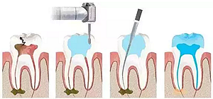 你總?cè)轮囱?ldquo;貴”還不是你自己造成的 你總?cè)轮囱?ldquo;貴”還不是你自己造成的