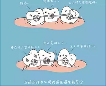 正畸需要注意些什么？