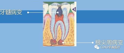 多頻技術(shù)的根管長度測定儀 多頻技術(shù)的根管長度測定儀